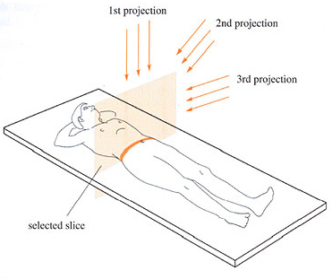 Imaging In Medicine: Printable Version